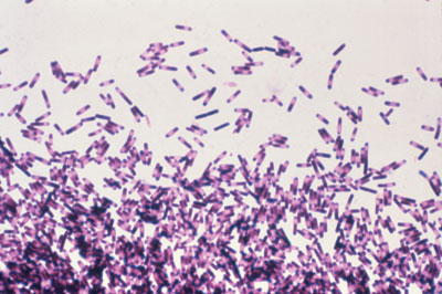 CDIA<sup>TM</sup> Clostridium Difficile Toxin A+B Test Card